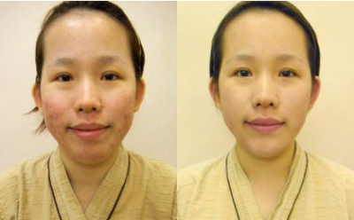 ヤクソンミョンガ